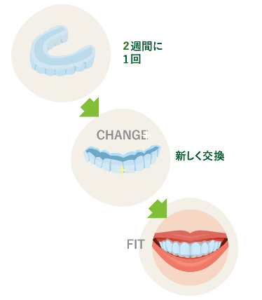 2週間ごとにマウスピースを交換します