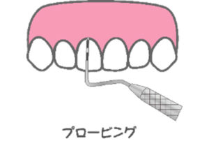 プロービングのイメージ