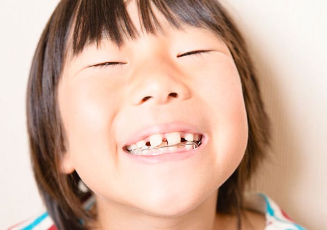 子どもの矯正治療