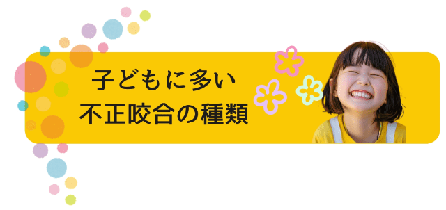 子どもに多い不正咬合（ふせいこうごう）の種類