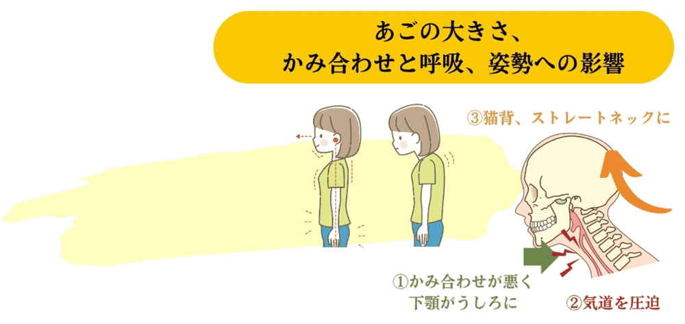 あごの大きさ、噛み合わせと呼吸、姿勢への影響