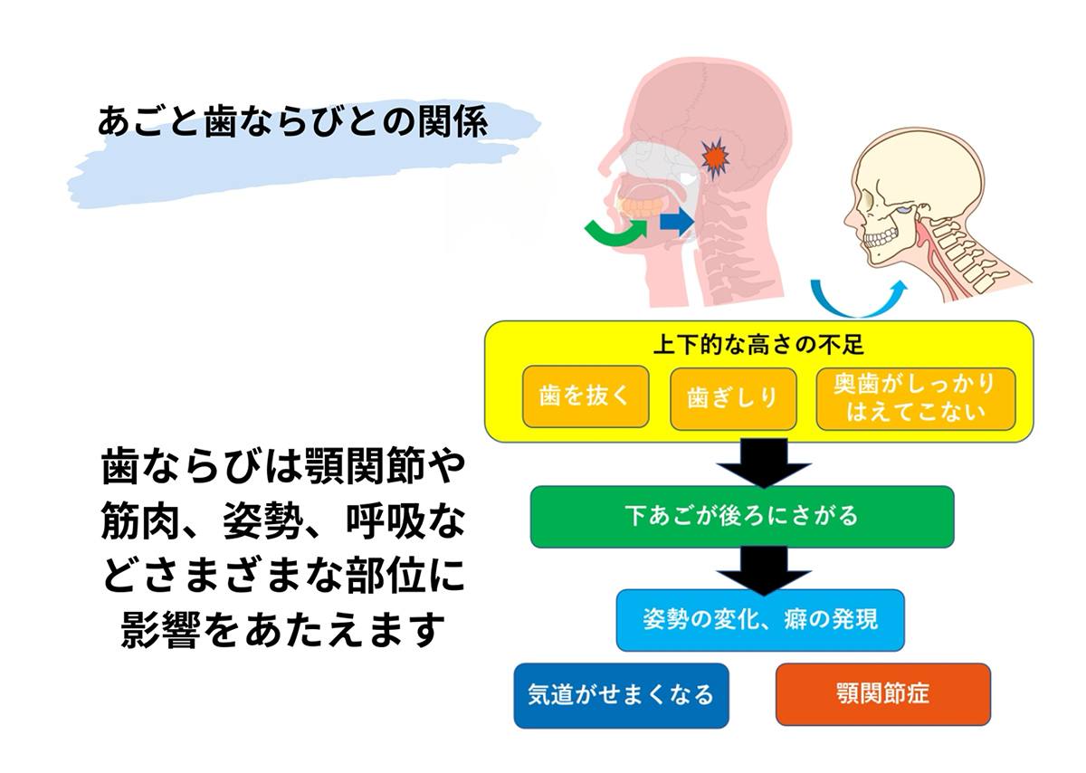 あごと歯ならびとの関係